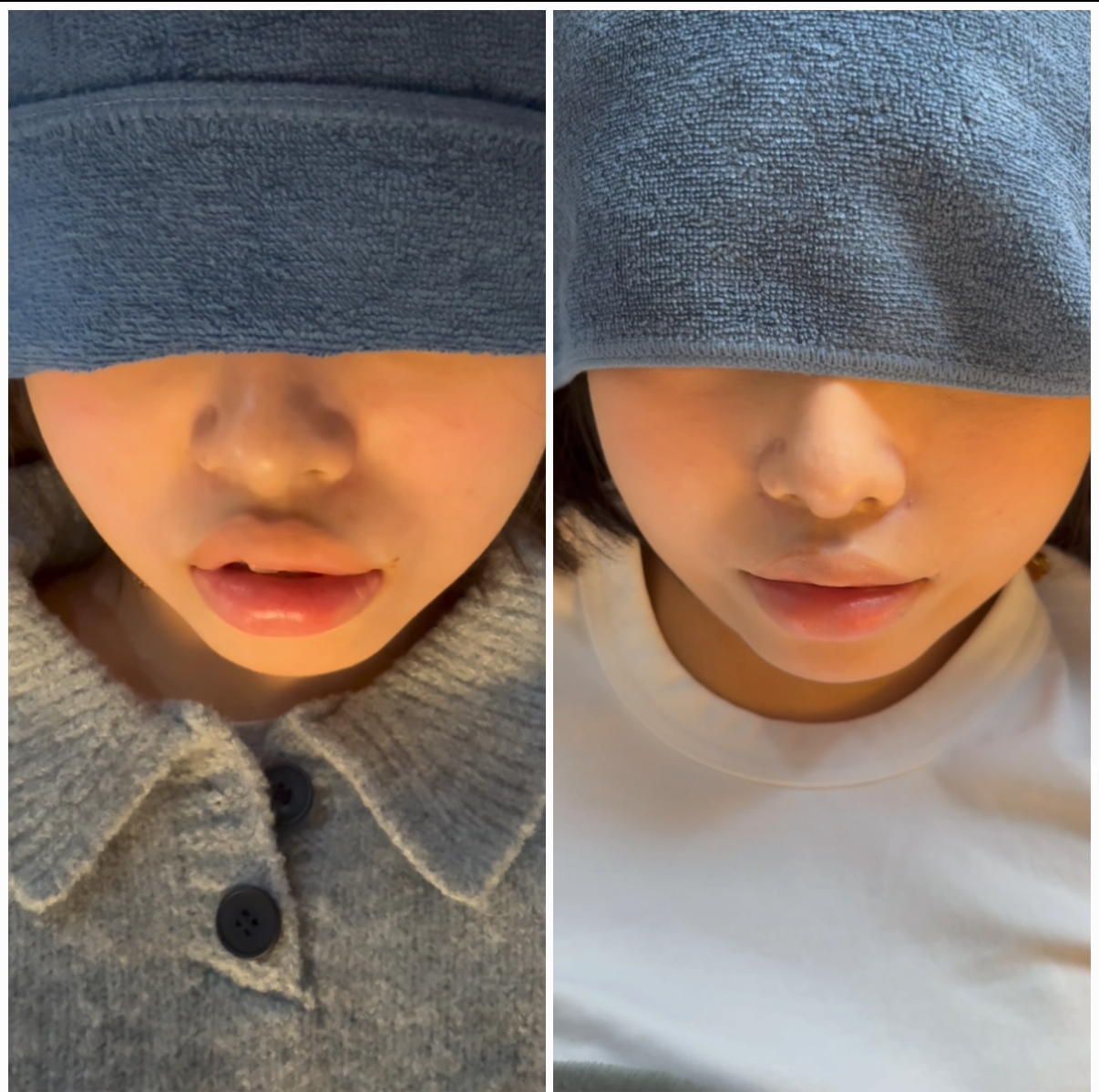 Transition in Lip Shape