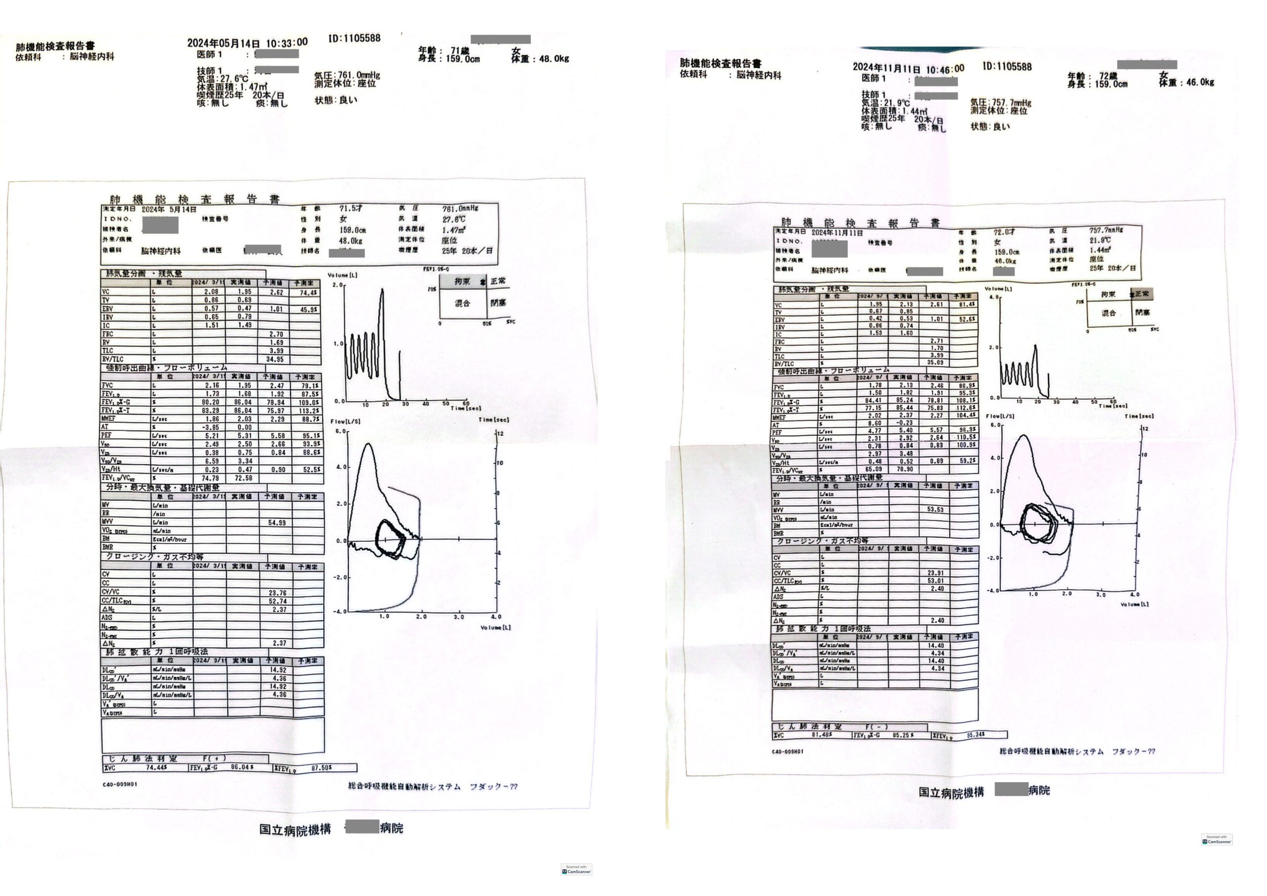 Actual Respiratory Test Results in ALS Patient
